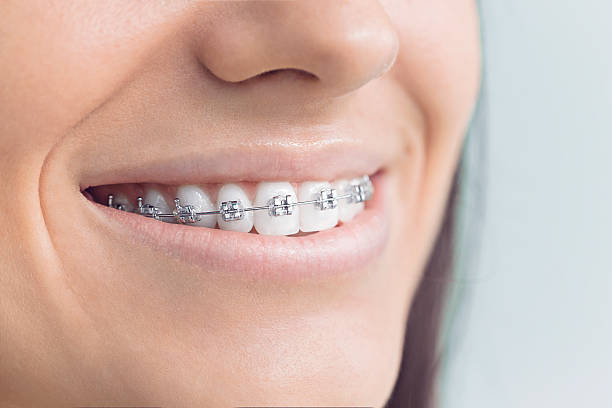 Best Preventive Dentistry  in Bellefontaine, OH